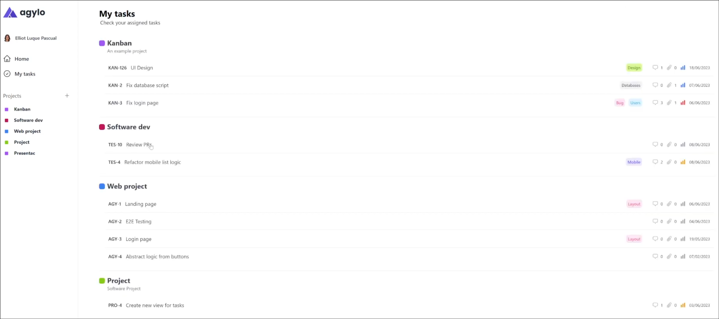 Global assigned tasks viewer